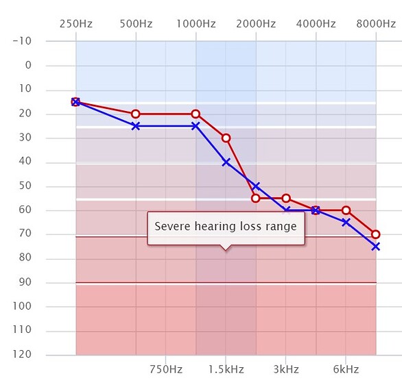 Audiogram learning - Hearing Aid Self-Fitting and Adjusting [DIY ...