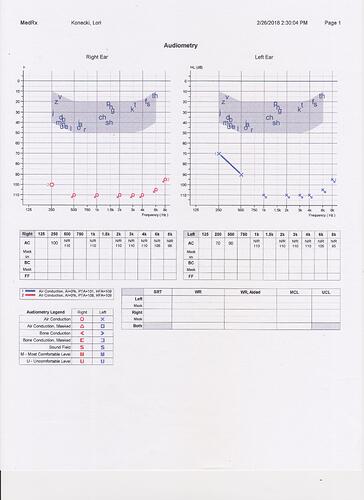 %20Audiogram2018