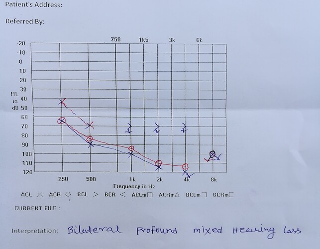 Audiometry