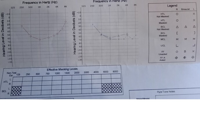 audiogram