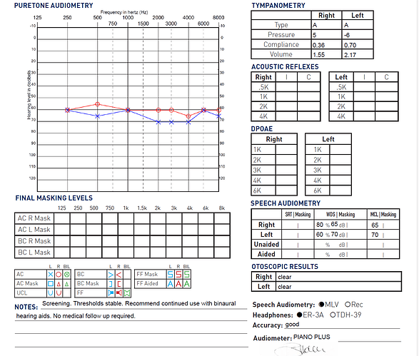Audiogram for Dad
